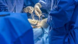 hernia mesh surgery