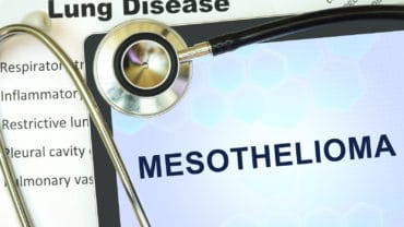 UK Family Settles with Medical Schools Over Doctor’s Mesothelioma Death