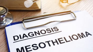 How MicroRNA May be Used to Diagnose Mesothelioma