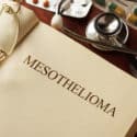 Electric Fields May Be a New Treatment Option for Mesothelioma Patients