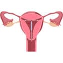Woman’s IUD Was in Her Abdomen for 11 Years