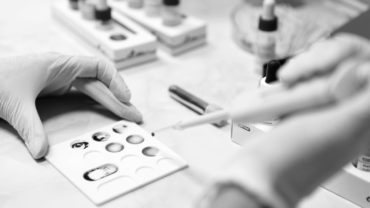Cancer Blood Test May Give Early Diagnosis for Mesothelioma