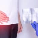 Atrium Medical Sets Aside $200 Million for Hernia Mesh Lawsuits