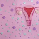 Essure Manufacturers Continue to Face Claims of Irreversible Harm From Usage