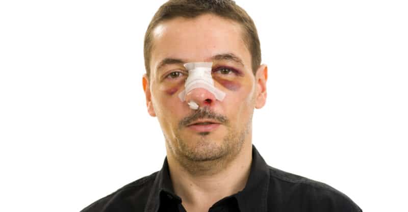 Injuries Happen Very Often And They Don’t Choose: How To Be Safe