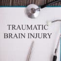 When will you need Traumatic Brain Injury Lawyers?