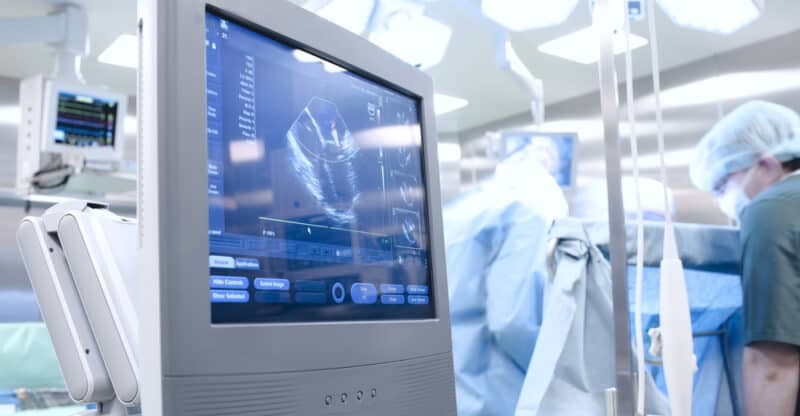 Amiodarone Lawsuits: What You Need to Know