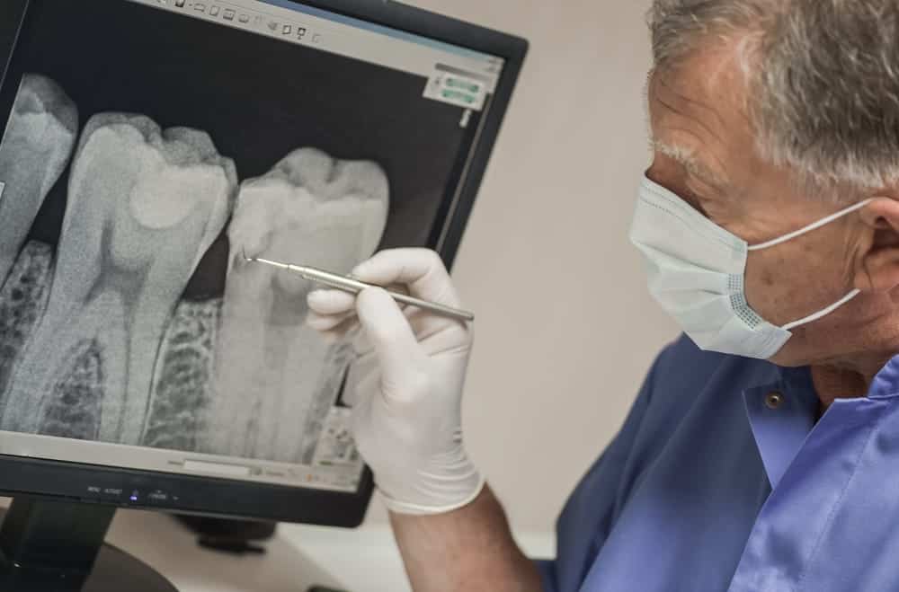 dental xray with doctor